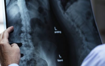 Schmerzensgeld nach einem Autounfall